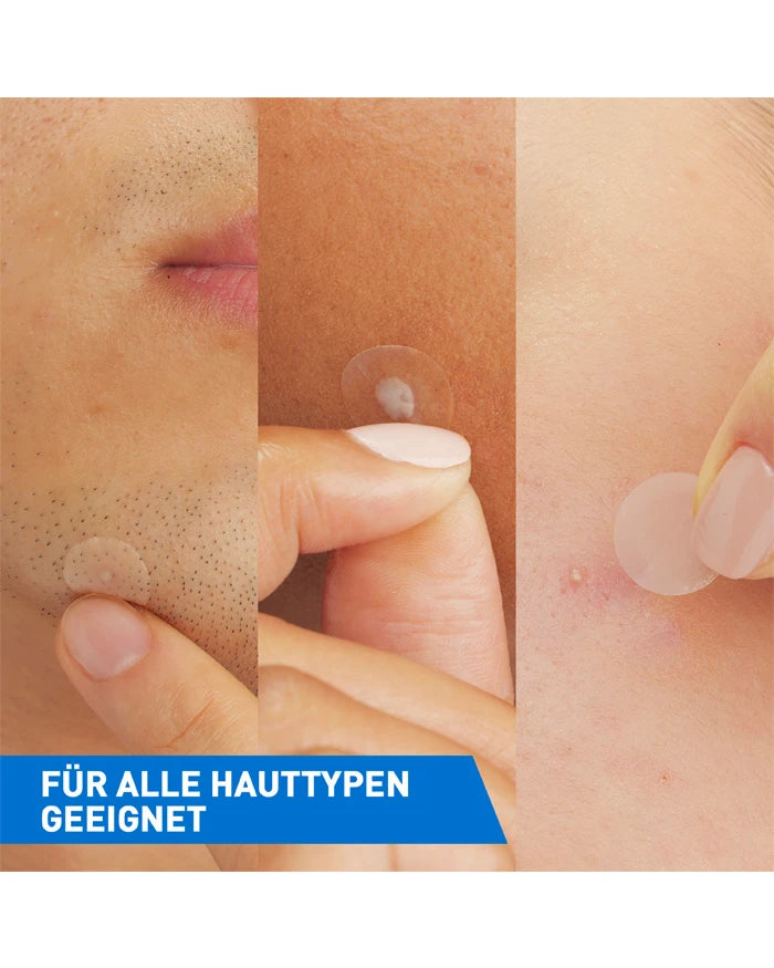 CeraVe Anti-Unreinheiten Patches – Bild 3
